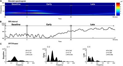 Strong Early Phase Parasympathetic Inhibition Followed by Sympathetic Withdrawal During Propofol Induction: Temporal Response Assessed by Wavelet-Based Spectral Analysis and Photoplethysmography